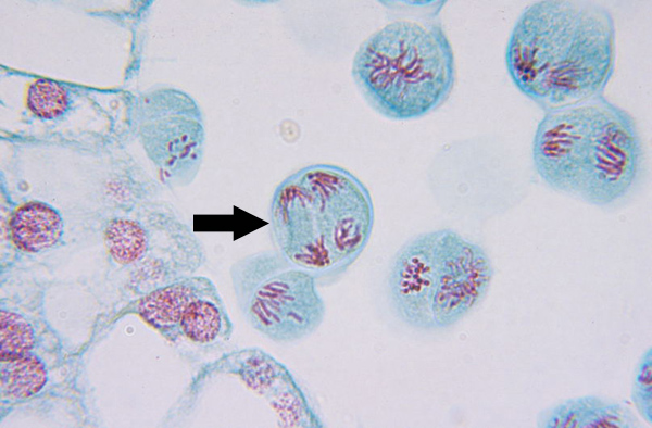 prophase microscope