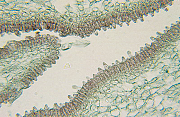 basidiomycota coprinus labeled