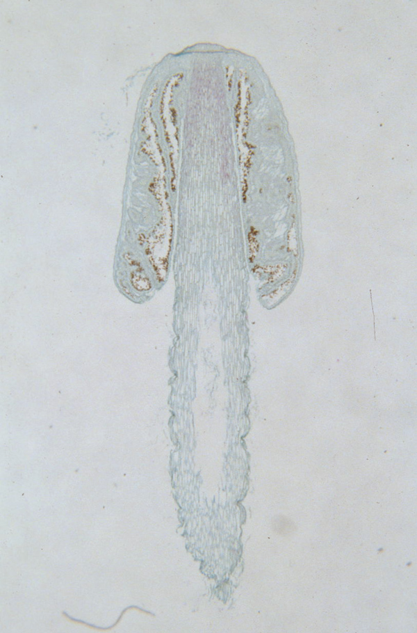 basidiomycota coprinus labeled
