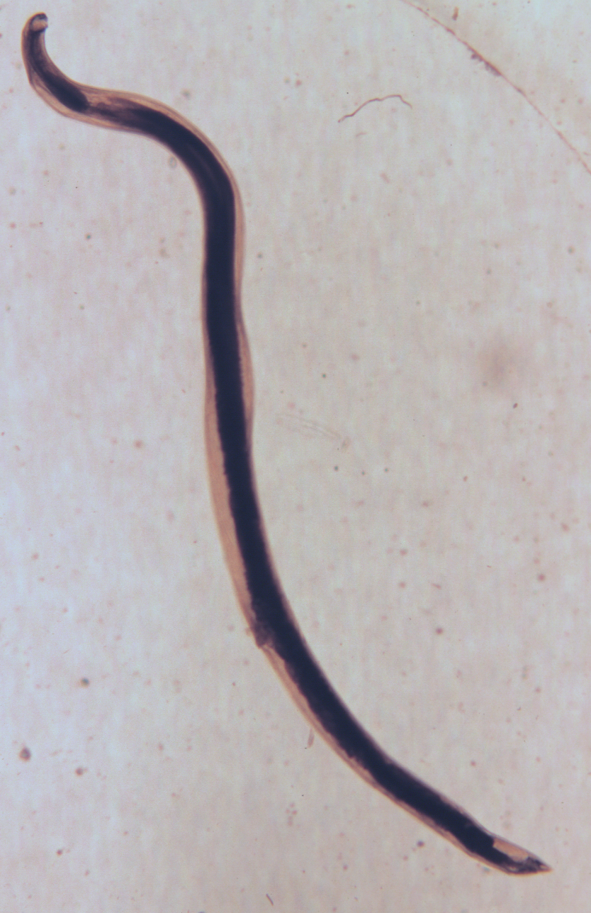 Coloured scanning electron micrograph (SEM) of Dog hookworm buccal capsule  (nematode, Ancylostoma caninum). This hookworm has pairs of teeth on the ve  Stock Photo - Alamy, image size:834x1287